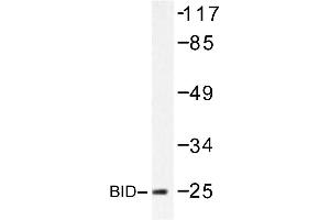 Image no. 1 for anti-BH3 Interacting Domain Death Agonist (BID) antibody (ABIN272120) (BID anticorps)