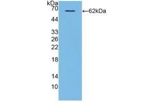 Detection of Recombinant CD40L, Human using Polyclonal Antibody to Cluster Of Differentiation 40 Ligand (CD40L) (CD40 Ligand anticorps  (AA 1-261))