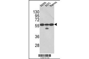 Western blot analysis of PDIA3 Antibody in A2058, A375, Ramos cell line lysates (35ug/lane)(2ug/ml) (PDIA3 anticorps  (AA 192-220))