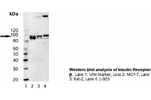 Image no. 1 for anti-Insulin Receptor (INSR) (Cytoplasmic Domain) antibody (ABIN331470) (Insulin Receptor anticorps  (Cytoplasmic Domain))
