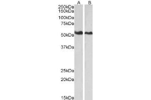 ABIN2561121 (0. (Annexin A11 anticorps  (N-Term))