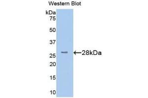 Western blot analysis of the recombinant protein. (STING/TMEM173 anticorps  (AA 159-373))