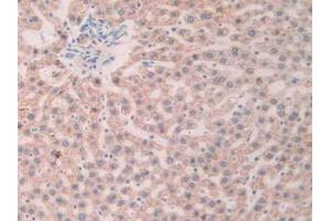 IHC-P analysis of Rat Liver Tissue, with DAB staining. (SLIT1 anticorps  (AA 308-512))