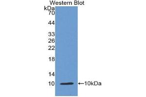 Western Blotting (WB) image for anti-Insulin (INS) (AA 25-110) antibody (ABIN1868717) (Insulin anticorps  (AA 25-110))