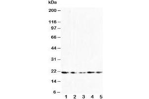 Western blot testing of FGF10 antibody and Lane 1:  U87;  2: HeLa;  3: A549;  4: 293T;  5: HeLa cell lysate (FGF10 anticorps  (N-Term))