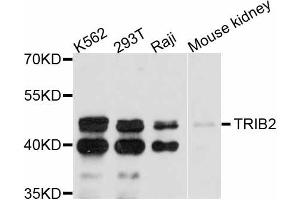 Western blot analysis of extracts of various cell lines, using TRIB2 antibody (ABIN4905491) at 1:3000 dilution. (TRIB2 anticorps)