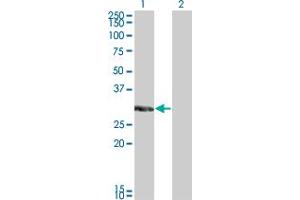 Western Blotting (WB) image for anti-Kv Channel Interacting Protein 2 (KCNIP2) (AA 1-100) antibody (ABIN466204) (KCNIP2 anticorps  (AA 1-100))