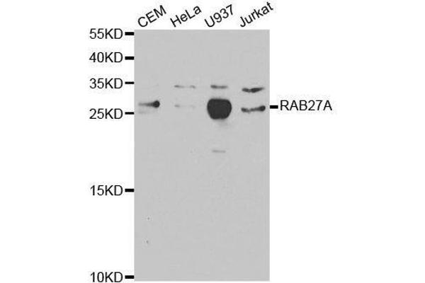 RAB27A anticorps  (AA 1-221)