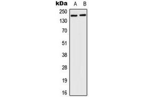 Western blot analysis of HCFC1 expression in HeLa (A), mouse brain (B) whole cell lysates. (HCFC1 anticorps  (N-Term))