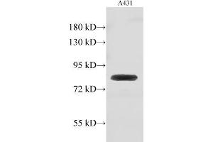 Western Blot analysis of A431 cell using GUSB Polyclonal Antibody at dilution of 1:500 (Glucuronidase beta anticorps)