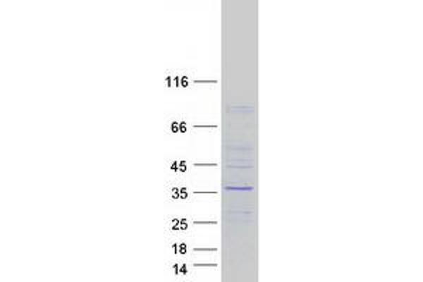 WDR61 Protein (Myc-DYKDDDDK Tag)