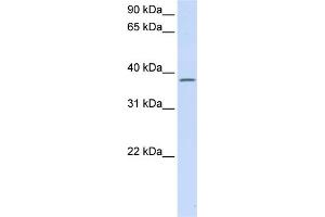 WB Suggested Anti-C21orf91 Antibody Titration:  0. (C21orf91 anticorps  (Middle Region))