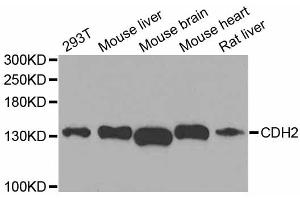 Western blot analysis of extracts of various cell lines, using CDH2 antibody (ABIN5995676) at 1/1000 dilution. (N-Cadherin anticorps)