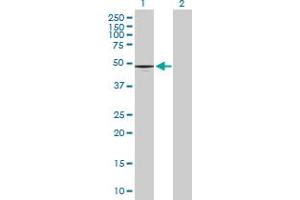 Western Blot analysis of CD177 expression in transfected 293T cell line by CD177 MaxPab polyclonal antibody. (CD177 anticorps  (AA 1-437))