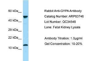 Western Blotting (WB) image for anti-Glycophorin A (GYPA) (N-Term) antibody (ABIN2789608) (CD235a/GYPA anticorps  (N-Term))