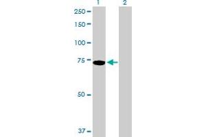 Lane 1: PIAS2 transfected lysate ( 63. (PIAS2 293T Cell Transient Overexpression Lysate(Denatured))