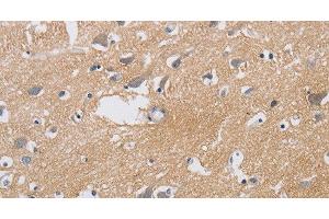 Immunohistochemistry of paraffin-embedded Human brain using KCNMB3 Polyclonal Antibody at dilution of 1:40 (KCNMB3 anticorps)
