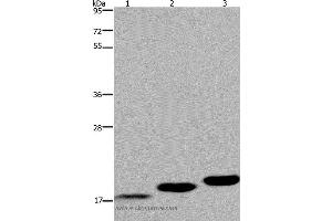 Western blot analysis of Mouse skeletal muscle, heart and bladder tissue, using MYL12B Polyclonal Antibody at dilution of 1:450 (MYL12B anticorps)