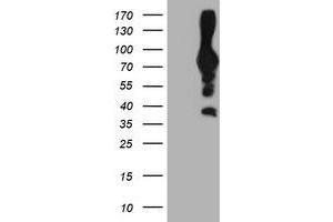 HEK293T cells were transfected with the pCMV6-ENTRY control (Left lane) or pCMV6-ENTRY PFKP (Right lane) cDNA for 48 hrs and lysed. (PFKP anticorps)