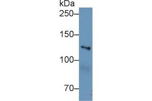 Western Blot; Sample: Human Hela cell lysate; Primary Ab: 1µg/ml Rabbit Anti-Mouse MYO1E Antibody Second Ab: 0. (MYO1E anticorps  (AA 772-1033))