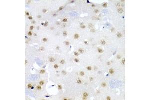 Immunohistochemistry of paraffin-embedded mouse brain using CDC27 antibody (ABIN5975347) at dilution of 1/200 (40x lens). (CDC27 anticorps)