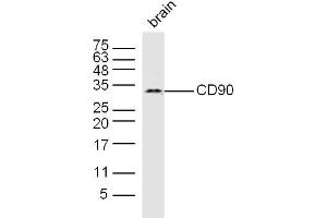 Image no. 3 for anti-CD90 (THY1) (AA 31-120) antibody (ABIN728038)