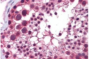 Human Testis: Formalin-Fixed, Paraffin-Embedded (FFPE) (HDAC6 anticorps  (N-Term))