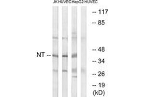 Western blot analysis of extracts from HuvEc/HepG2/Jurkat cells, using NT Antibody. (NT (AA 235-284) anticorps)