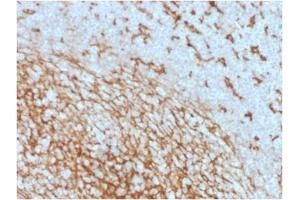 ABIN6383875 to CD14 was successfully used to stain membranes of macrophages in human lymph node and tonsil sections. (CD14 anticorps  (Extracellular Domain))