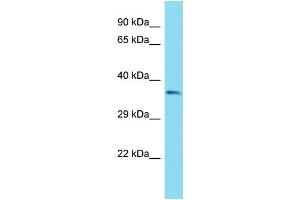Host: Rabbit Target Name: OR51B6 Sample Type: ACHN Whole Cell lysates Antibody Dilution: 1. (OR51B6 anticorps  (C-Term))
