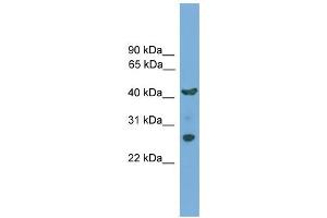 WB Suggested Anti-TMEM176A Antibody Titration:  0. (TMEM176A anticorps  (N-Term))