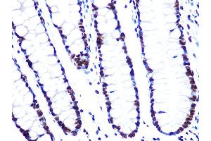 Immunohistochemistry of paraffin-embedded human colon using L Rabbit mAb (ABIN7270266) at dilution of 1:100 (40x lens). (ASH2L anticorps)