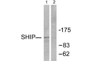 Western Blotting (WB) image for anti-Inositol Polyphosphate-5-Phosphatase, 145kDa (INPP5D) (C-Term) antibody (ABIN1848769) (INPP5D anticorps  (C-Term))