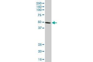 KLF10 monoclonal antibody (M14), clone 2E7. (KLF10/TIEG1 anticorps  (AA 111-210))