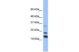 WB Suggested Anti-C1D Antibody Titration:  0. (C1D anticorps  (Middle Region))