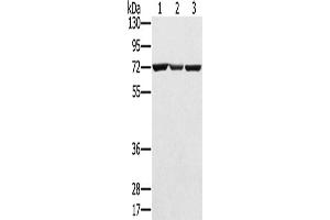Western Blotting (WB) image for anti-Solute Carrier Family 25, Member 13 (Citrin) (slc25a13) antibody (ABIN2424162) (slc25a13 anticorps)