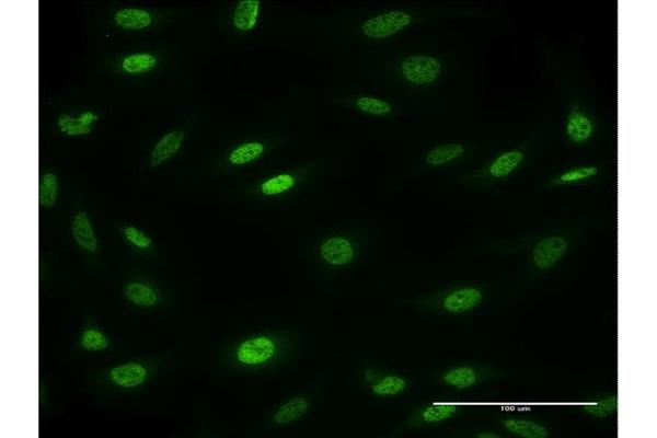 Mesp2 anticorps  (AA 2-125)