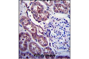P Antibody (C-term ) 6306c immunohistochemistry analysis in formalin fixed and paraffin embedded human kidney tissue followed by peroxidase conjugation of the secondary antibody and DAB staining. (APP anticorps  (C-Term))