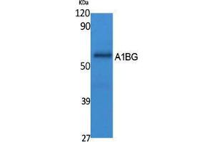 Western Blotting (WB) image for anti-alpha-1-B Glycoprotein (A1BG) (Internal Region) antibody (ABIN3178089) (A1BG anticorps  (Internal Region))