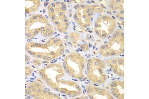 Immunohistochemistry of paraffin-embedded human kidney using ELMO3 antibody. (ELMO3 anticorps)