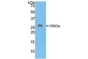 Detection of Recombinant PKD2, Human using Polyclonal Antibody to Protein Kinase D2 (PKD2) (PKD2 anticorps  (AA 621-832))