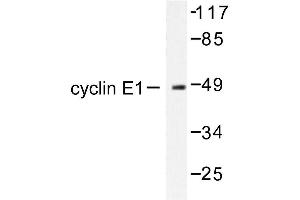 Image no. 1 for anti-Cyclin E1 (CCNE1) antibody (ABIN265379) (Cyclin E1 anticorps)