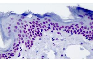 Immunohistochemistry (Formalin-fixed Paraffin-embedded Sections) (IHC (fp)) image for anti-Histone H4 (acLys12) antibody (ABIN604836)