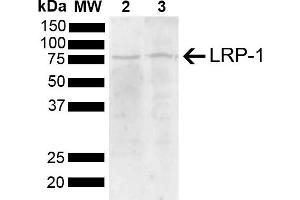 Western blot analysis of Mouse, Rat Brain showing detection of 504. (LRP1 anticorps  (AA 160-260) (PE))