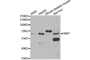 Western blot analysis of extracts of various cell lines, using PNKP antibody. (PNKP anticorps)