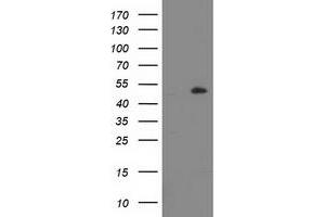 HEK293T cells were transfected with the pCMV6-ENTRY control (Left lane) or pCMV6-ENTRY LPL (Right lane) cDNA for 48 hrs and lysed. (Lipoprotein Lipase anticorps)