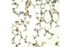 Immunohistochemistry of paraffin-embedded mouse lung using FBXW11 antibody. (FBXW11 anticorps)