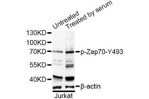 Western blot analysis of extracts of Jurkat cells, using Phospho-ZAP70-Y493 antibody (ABIN2988352) at 1/1000 dilution. (ZAP70 anticorps  (pTyr493))