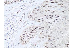 Immunohistochemistry of paraffin-embedded human skin using TP63 antibody. (TCP1 alpha/CCTA anticorps)