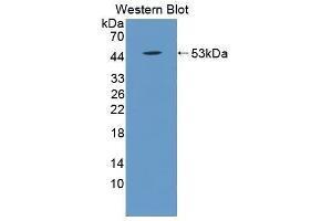 Western Blotting (WB) image for anti-Peroxiredoxin 1 (PRDX1) antibody (FITC) (ABIN1175814) (Peroxiredoxin 1 anticorps  (FITC))